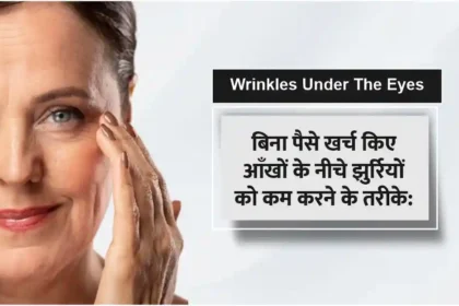 7 easy home remedies to reduce wrinkles under the eyes
