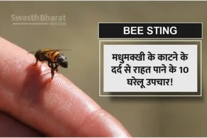 Bee Bite Symptoms and 10 Home Remedies