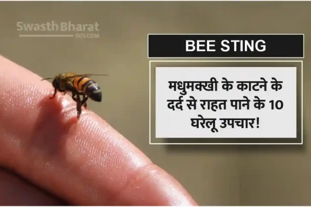Bee Bite Symptoms and 10 Home Remedies